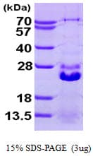Human HSPB7 / CvHSP Protein (Recombinant His)