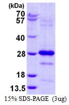 Human PLDN / Pallidin Protein (Recombinant His)