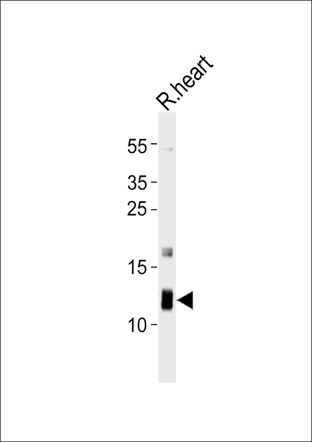 ATP5J Antibody (aa28-56)