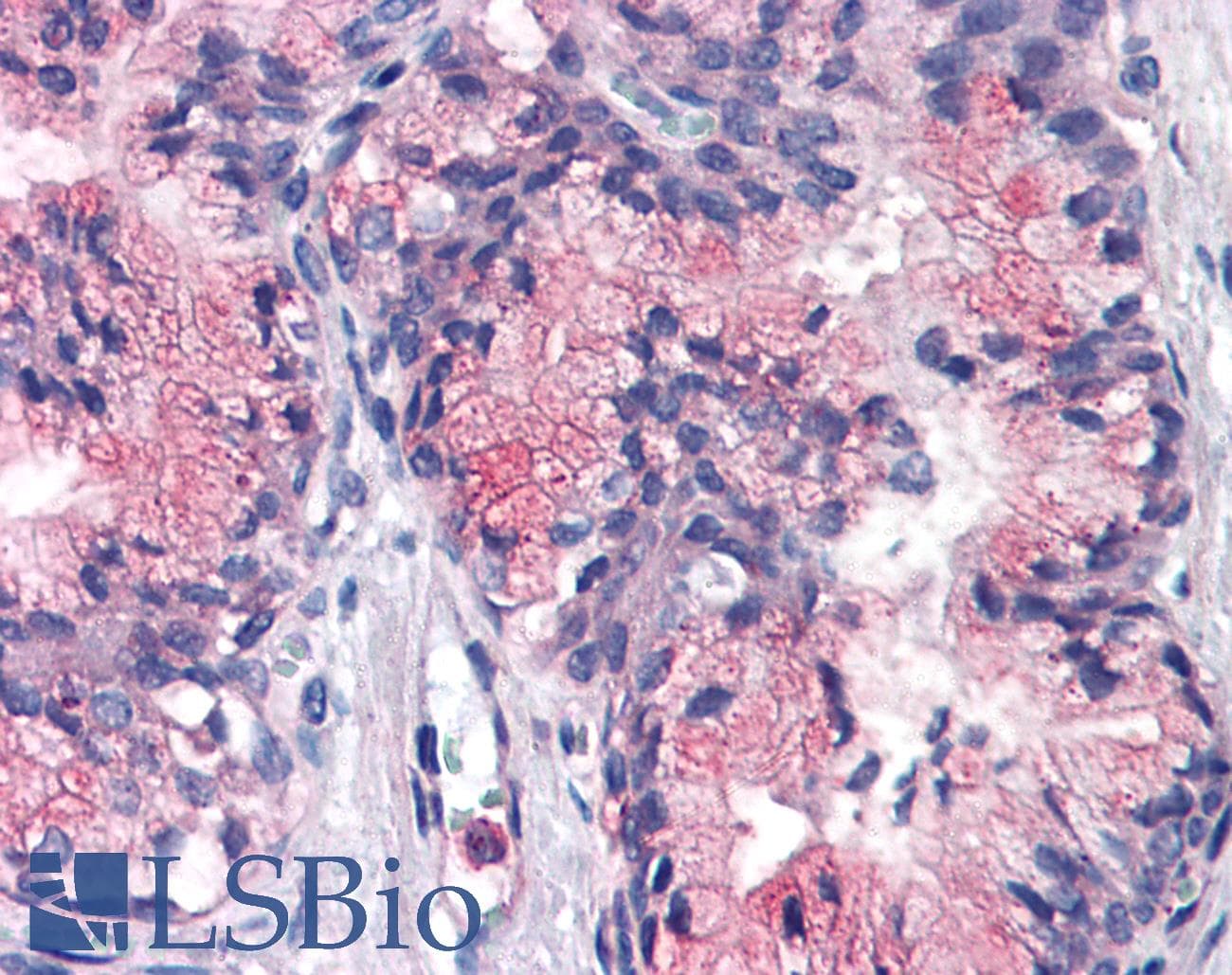 IHC-plus™ ATP1B3 Antibody (Internal)