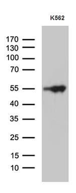 VRK2 Antibody (aa301-486, clone OTI2F5)