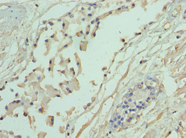ADD1 / Adducin Alpha Antibody (aa60-300)