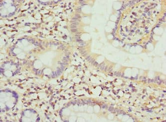 FGF19 Antibody