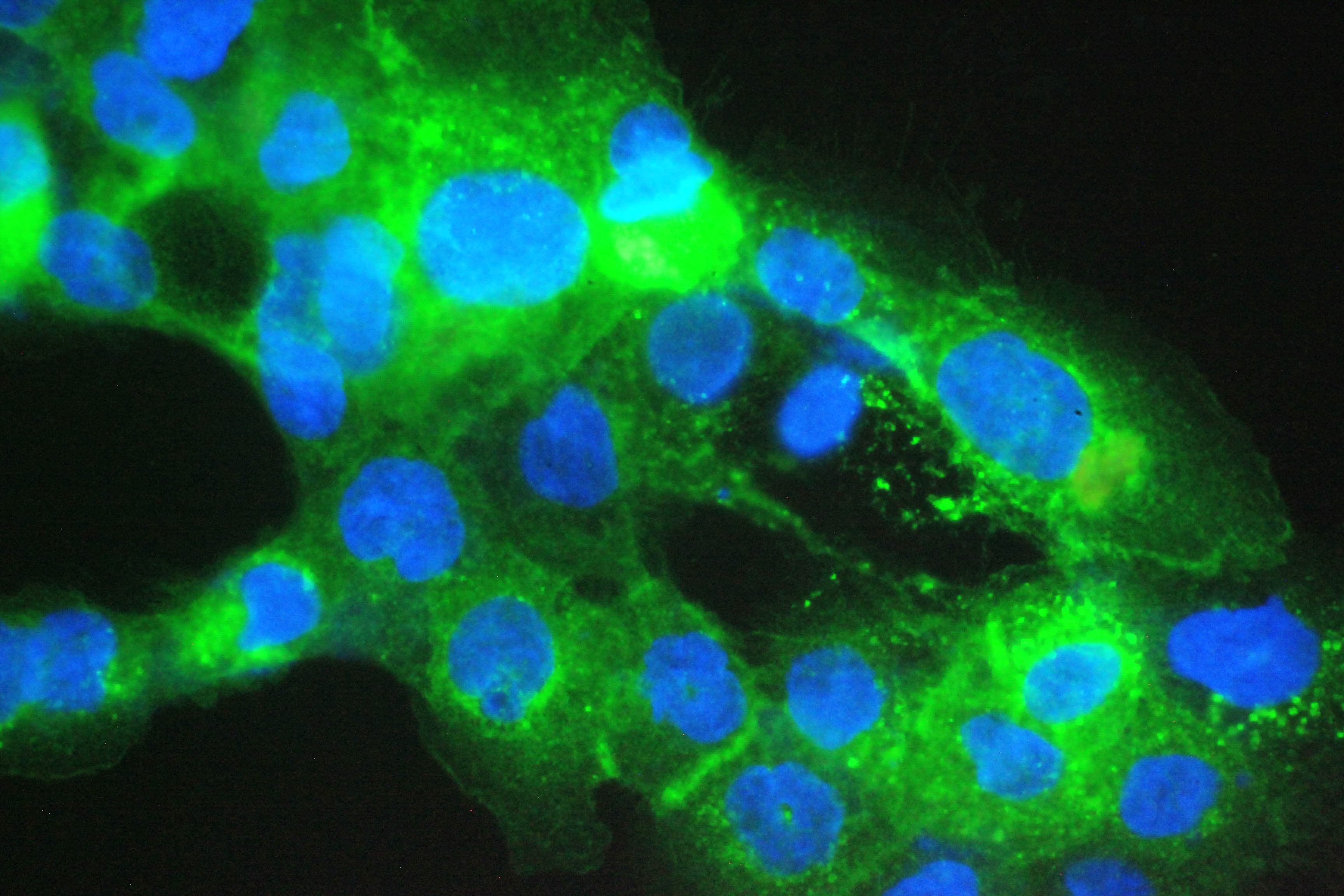 Polyclonal Rabbit anti-Human B2M / Beta 2 Microglobulin Antibody (IHC, WB)