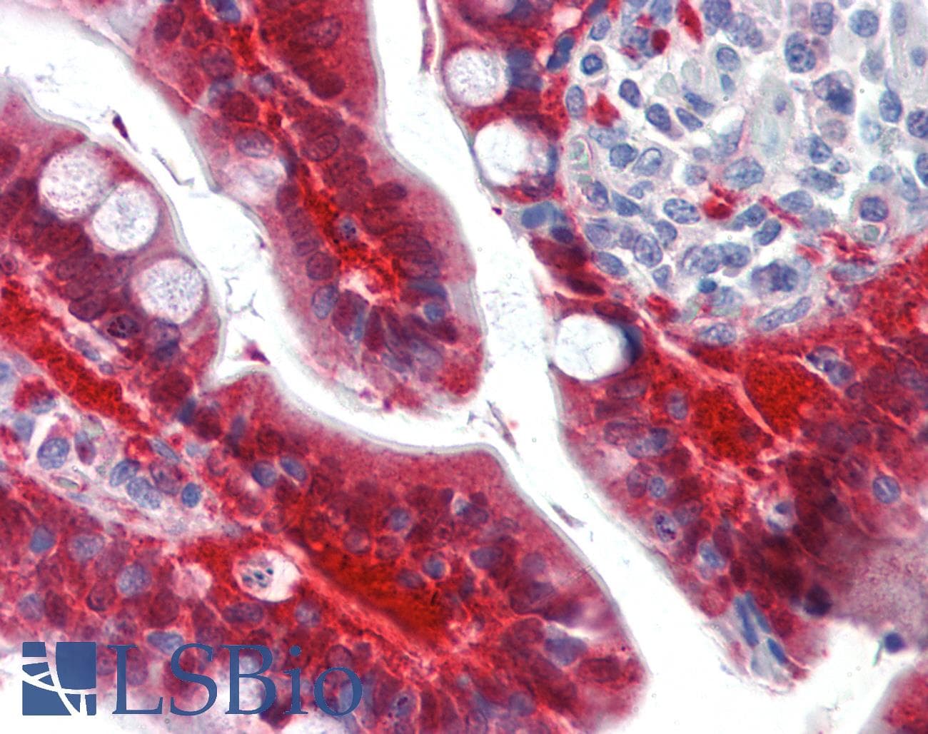 Monoclonal Mouse anti-Human LGALS3 / Galectin 3 Antibody (clone 1G8, Carrier-free, IHC, IF, WB)