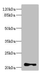 TNNI2 Antibody