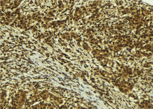 Polyclonal Rabbit anti-Human ZNF295 Antibody (IHC, WB)