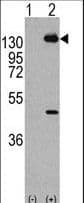 IHC-plus™ PDGFRA / PDGFR Alpha Antibody (Tyr768)