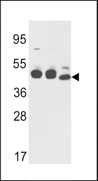 IHC-plus™ KRT18 / CK18 / Cytokeratin 18 Antibody (aa401-430)
