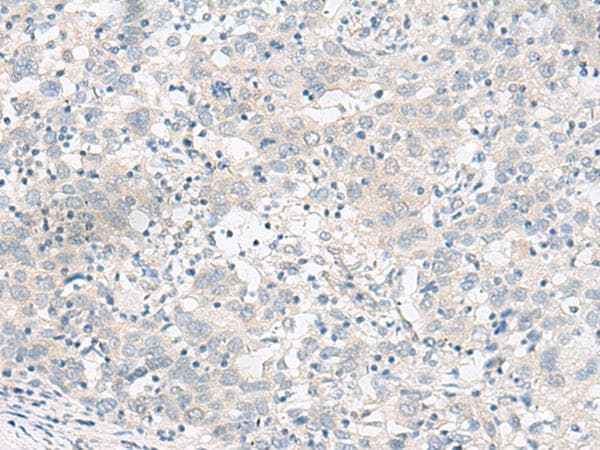 GARNL1 / RALGAPA1 Antibody