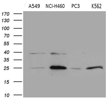 SLC9A1BP / CHP Antibody (clone OTI1D11)