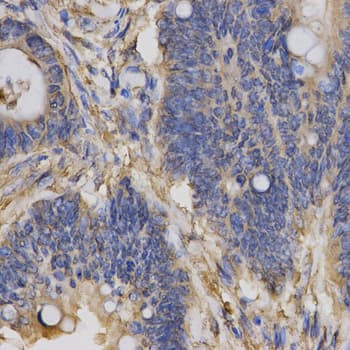 Polyclonal Rabbit anti-Human ClC-5 / CLCN5 Antibody (IHC, IF, WB)