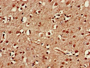 Polyclonal Rabbit anti-Human TAF1A Antibody (IHC, WB)
