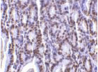 Gestrinone Antibody