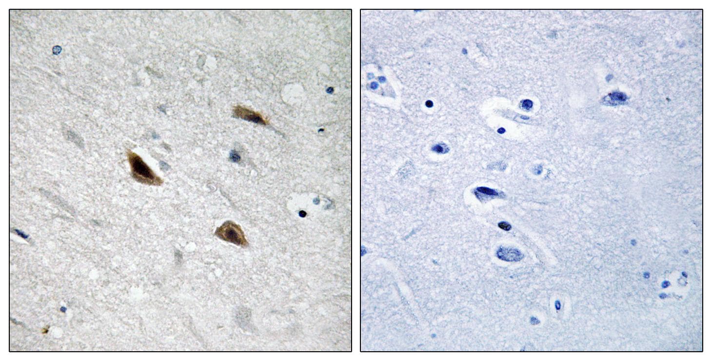 Polyclonal Rabbit anti-Human CTNNB1 / Beta Catenin Antibody (phospho-Tyr489, IHC, WB)