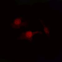 PTEN Antibody (C-Terminus)