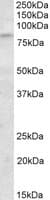 Polyclonal Goat anti-Human KLHL6 Antibody (aa306-319, WB)