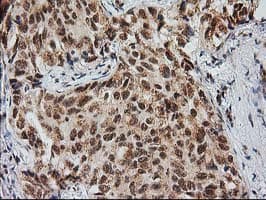 Monoclonal Mouse anti-Human MGLL / Monoacylglycerol Lipase Antibody (clone OTI1H1, IHC, IF, WB)