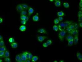 APP / Beta Amyloid Precursor Antibody (clone OTI2B10)