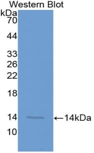 MTNR1A / Melatonin Receptor 1a Antibody (aa216-257)