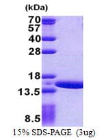 Human NATD1 / C17orf103 Protein (Recombinant His)