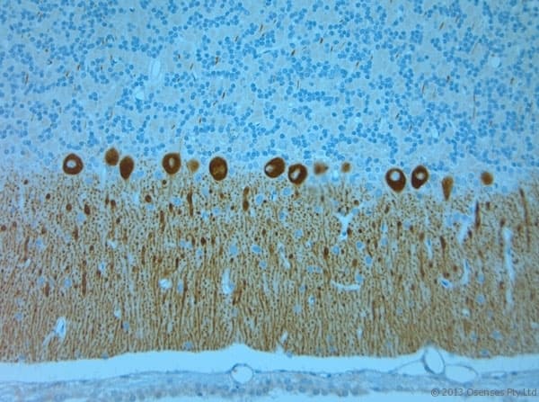 Polyclonal Rabbit anti-Human ITPR1 / IP3 Receptor Type 1 Antibody (aa700-750, IHC)