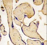 EPHA3 / EPH Receptor A3 Antibody (aa896-928)