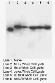 DNTT / TdT Antibody (C-Terminus)
