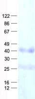 Human LRRC17 Protein (Recombinant His, N-Terminal)