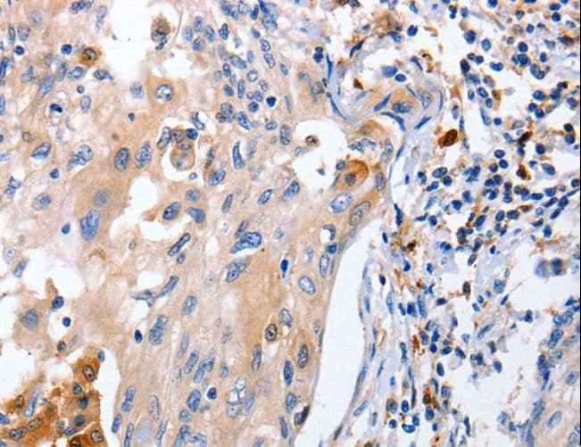 IL18 Antibody
