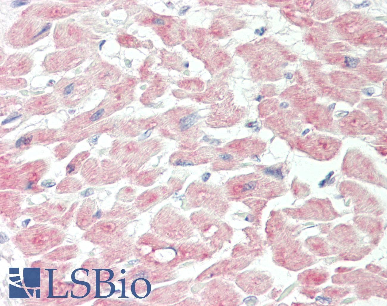 Polyclonal Rabbit anti-Human ANGPTL3 Antibody (aa43-92, IHC, WB)