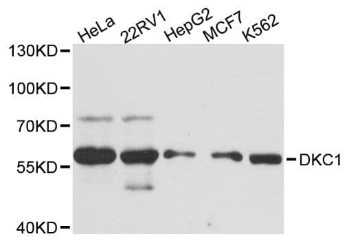 DKC1 / Dyskerin Antibody