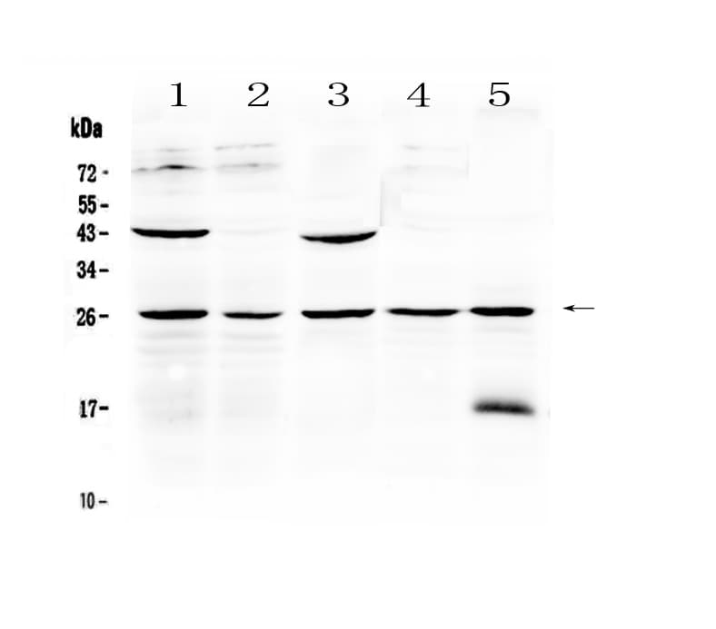 NOG / Noggin Antibody