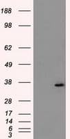 IHC-plus™ Monoclonal Mouse anti-Human AKR1A1 Antibody (clone 10E11, IHC, WB)