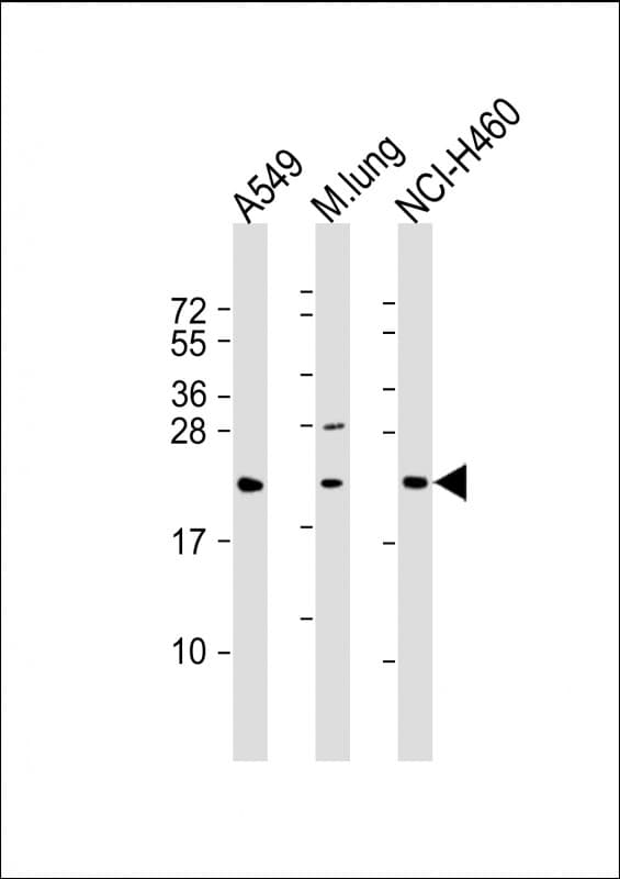 Polyclonal Rabbit anti-Human TUSC1 Antibody (N-Terminus, WB)