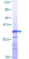 Human TGM5 / Transglutaminase 5 Protein (Recombinant GST, N-terminus)