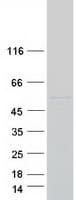 Human CYP26 / CYP26A1 Protein (Recombinant Myc-DDK (Flag))