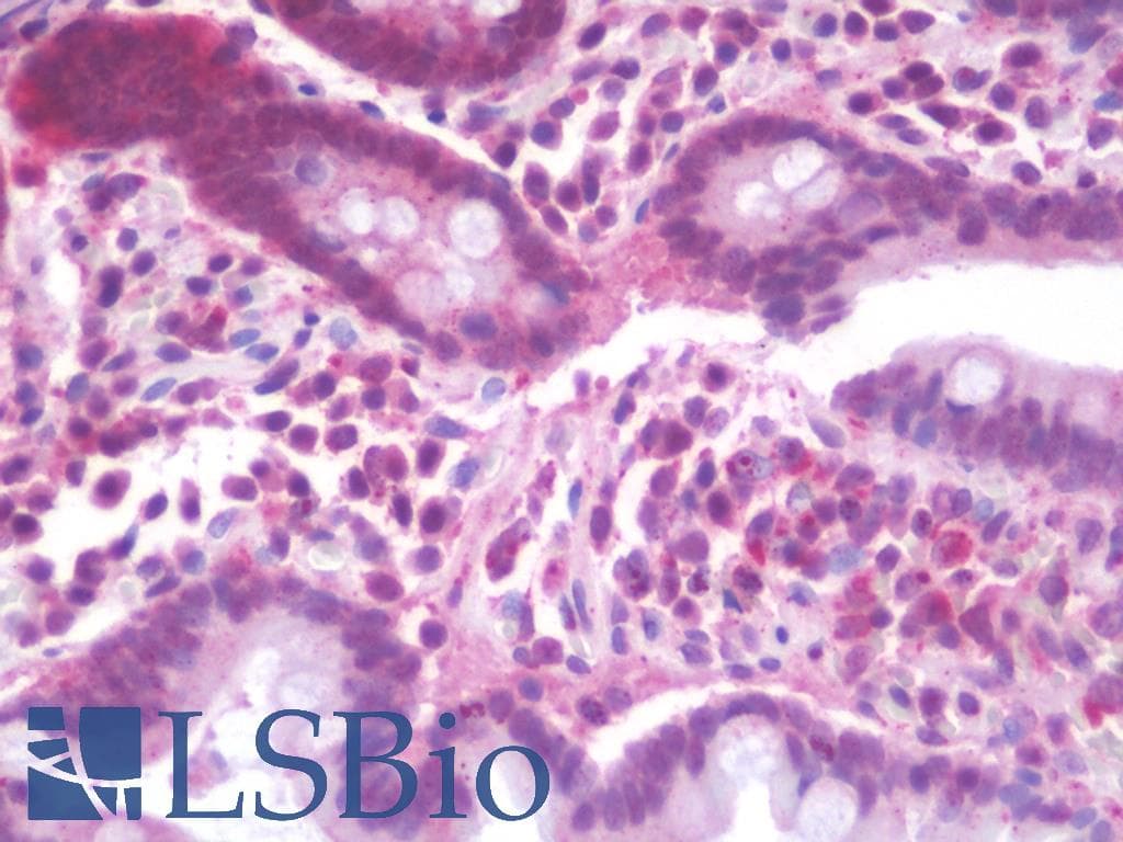 IHC-plus™ Polyclonal Rabbit anti-Human ZDHHC20 Antibody (aa72-121, IHC, WB)