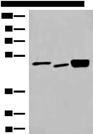 Polyclonal Rabbit anti-Human DMTN / Dematin Antibody (IHC, WB)
