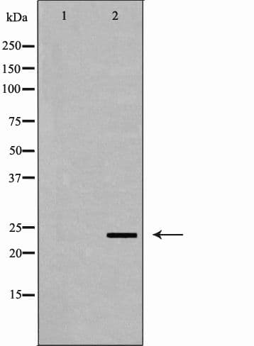 Polyclonal Rabbit anti-Human ORM1 / Orosomucoid Antibody (aa127-149, IHC, WB)