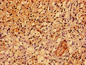 ASPM Antibody