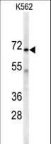 Polyclonal Rabbit anti-Human AK7 / Adenylate Kinase 7 Antibody (aa629-656, IHC, WB)