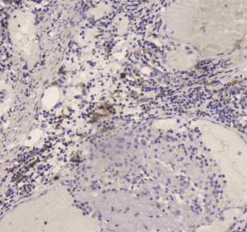Polyclonal Rabbit anti-Human CD209 / DC-SIGN Antibody (IHC, WB)