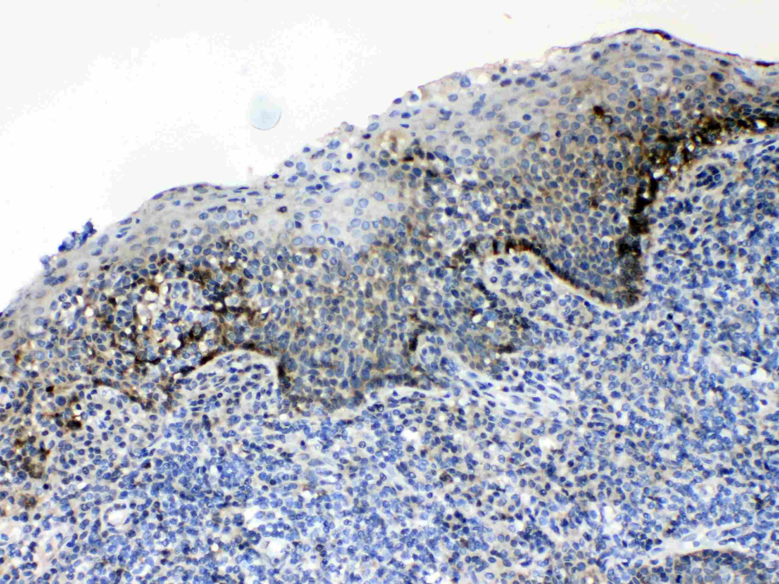 ALCAM / CD166 Antibody