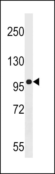AGAP3 / CENTG3 / MRIP-1 Antibody (aa190-217)