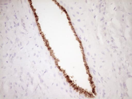 PROCR / EPCR Antibody (aa1-210, clone OTI3E7)