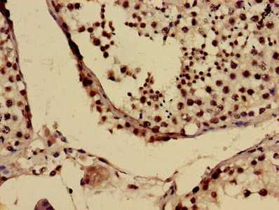 Polyclonal Rabbit anti-Human US01 / p115 Antibody (IHC, IF)