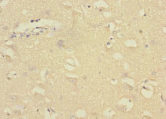 Polyclonal Rabbit anti-Human CR6 / GADD45G Antibody (IHC, WB)