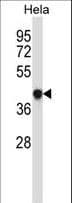 GRINA Antibody (aa131-158)