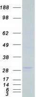 Human LRP5L Protein (Recombinant Myc-DDK (Flag))